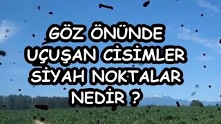 GÖZ ÖNÜNDE UÇUŞAN CİSİMLER SİYAH NOKTALAR NEDİR [upl. by Nyvets]