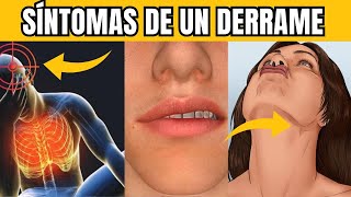 7 SÍNTOMAS de un ACV Derrame Cerebral antes de que OCURRA [upl. by Harbour]