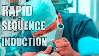 Rapid Sequence Induction or rapid sequence intubation [upl. by Gerek]