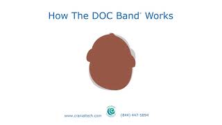 How The DOC Band® Works [upl. by Meyeroff]