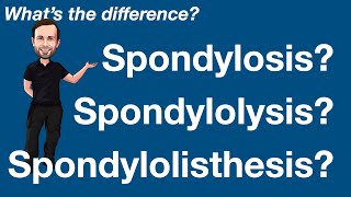 The difference between Spondylosis Spondylolysis Spondylolisthesis [upl. by Hopfinger260]