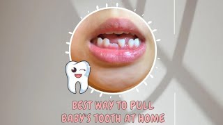 Painless Trick for Pulling Baby Teeth FAST [upl. by Lebatsirc957]