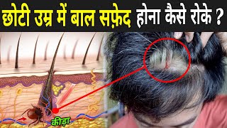 छोटी उम्र में बाल सफ़ेद होना कैसे रोके   How To Stop White Hair Growth In Young Age [upl. by Edivad55]