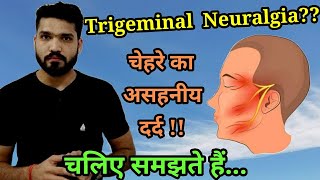 Trigeminal Neuralgia  Severe facial pain  Causes Trigger points Treatment [upl. by Mariam948]