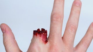 تعمل اية لو شخص صباعة أتقطع وكيف تحافظ علي الجزء المبتورFirst aid for finger amputation [upl. by Ayadahs5]