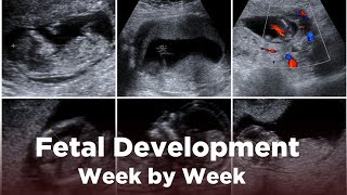 Fetal Development Week by Week  A Journey to Birth  Pregnancy Guide [upl. by Tomkins]