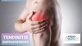 Ejercicios TENDINITIS SUPRAESPINOSO [upl. by Kinemod109]