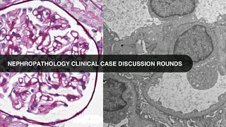 20240220 Nephropathology Clinical Case Discussion Rounds [upl. by Delp340]