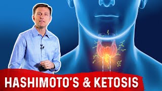 Hashimotos Disease Hypothyroid and Keto Ketogenic Diet – Dr Berg [upl. by Pryor]