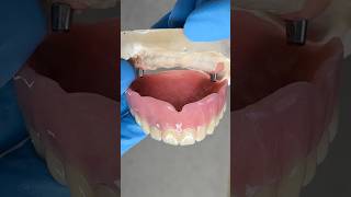 Finished Relining a Denture lsk121shorts dentist dentistteeth [upl. by Telracs]