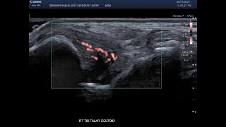 Excerpt from the MSK Imaging Fundamentals  Ankle and Foot [upl. by Yecats]