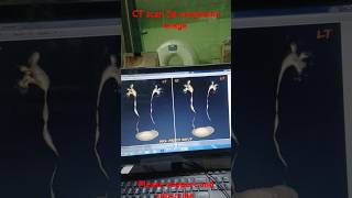 CT scan 3d urography final image reportshortvideo anatomy [upl. by Essyle]