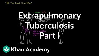 Extrapulmonary TB part 1  Infectious diseases  NCLEXRN  Khan Academy [upl. by Nerta]