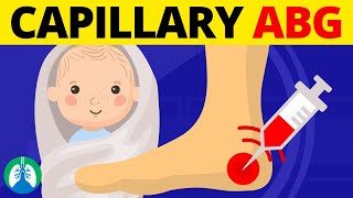 Puncture Site for a Capillary Blood Sample in Infants TMC Practice Question [upl. by Wendin999]