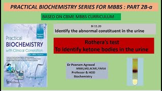 Rotheras Test  Ketone Body Detection in Urine  Sodium Nitroprusside Test  MBBS Practical  CBME [upl. by Zak]