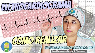 ELETROCARDIOGRAMA Como é Realizado [upl. by Syman495]