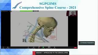 Anterior VS Posterior approach for Cervical compressive myelopathy Dr Manas Panigrahi Krishna Ins [upl. by Elane]