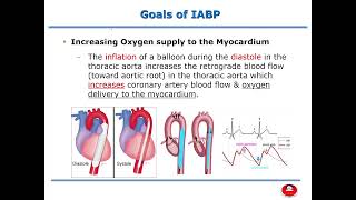 Critical Care NursingLecture 15 IntraAortic Balloon Pump IABP  Part 1 [upl. by Gilliette]