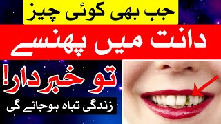 Dant Me Gosht Phase To Khabardar  Mehrban Ali  Teeth [upl. by Jephum]