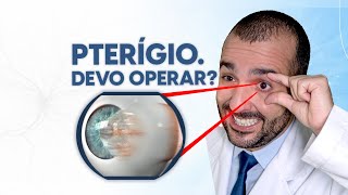 Pterígio precisa de cirurgia Como tratar • Dr Gustavo Bonfadini [upl. by Inimak]