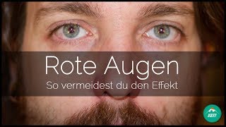 ROTE AUGEN VERMEIDEN  so entstehen rote Augen und so vermeidest du sie  QUICKTIP [upl. by Oiziruam902]