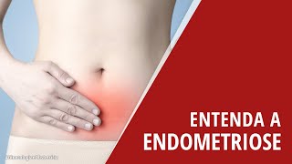 Entenda a Endometriose [upl. by Bounds]