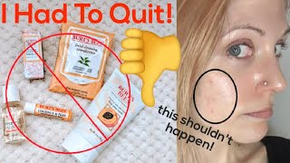 Why I Cant Use Burts Bees [upl. by Towill]