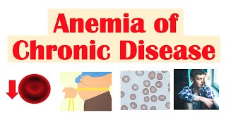 Anemia of Chronic Disease  Causes Pathophysiology Signs amp Symptoms Diagnosis Treatment [upl. by Niasuh]