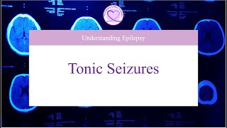 What are Tonic Seizures [upl. by Mcilroy918]