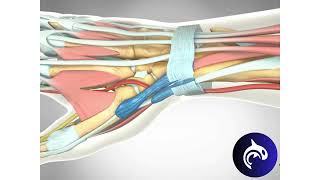 Quick View  De Quervain’s Tenosynovitis Release  3D Animation [upl. by Okubo]