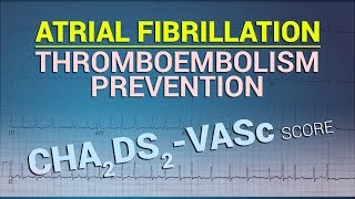 Thromboembolism Prevention in Atrial Fibrillation  CHA2DS2VASc Score [upl. by Annaili]