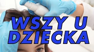 Wszy u dziecka – Jak sprawdzić i szybko zareagować [upl. by Arimihc]