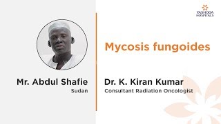 Mycosis Fungoides Treatment in India  Sudan  Yashoda Hospitals [upl. by Ahseinat]