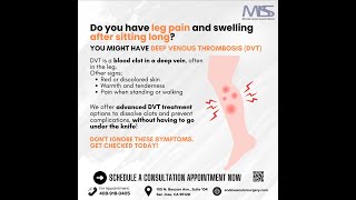 Leg Swelling Might be Deep Venous Thrombosis [upl. by Nilekcaj]