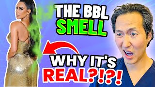 Plastic Surgeon Reacts to the BBL SMELL Why BBLs Stink [upl. by Aufmann]