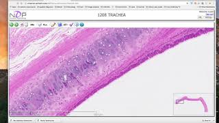 Hyaline cartilage histology demonstration [upl. by Cloots]