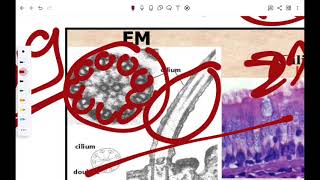 cytoskeletonampinclusion [upl. by Ikcin]