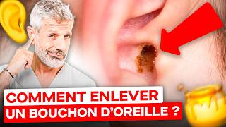 Comment Enlever un Bouchon de Cérumen  huile dolive bougies 😮 [upl. by Ardnasela969]