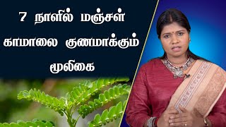 7 நாளில் மஞ்சள் காமாலை குணமாக்கும் மூலிகை  Jaundice Treatment Natural Cure  Dr B Yoga Vidhya [upl. by Dhruv366]