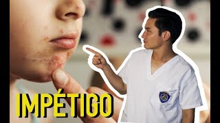 IMPÉTIGO Infección bacteriana en niños👶👦👧 [upl. by Sylado483]