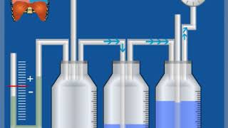 4KammerSystem – Funktionsweise  Thoraxdrainage für Einsteiger [upl. by Annor]