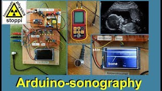 ultrasonic body sonography with arduino  part 2 [upl. by Olra]