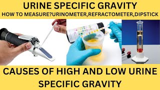 URINE SPECIFIC GRAVITYHOW TO MEASURECAUSES OF HIGH AND LOW SPECIFIC GRAVITYURINE ROUTINE [upl. by Landers]