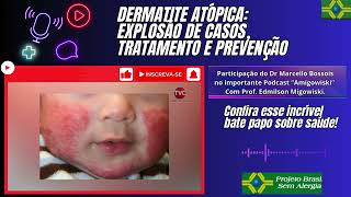 DERMATITE ATÃ“PICA EXPLOSÃƒO DE CASOS TRATAMENTO E PREVENÃ‡ÃƒO [upl. by Clayborn]