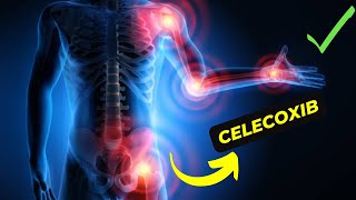 Celecoxib vs Other NSAIDs Which Is Better for Arthritis Pain Relief [upl. by Palua]