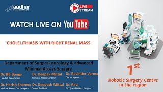 CHOLELITHIASIS WITH RIGHT RCC [upl. by Boyce]