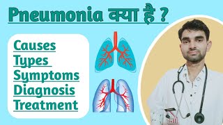 Pneumonia in Hindi  Causes Sing amp Symptoms of Pneumonia  Treatment of Pneumonia [upl. by Eisned]