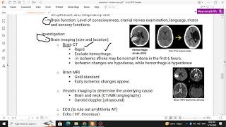 NS Medicine Stroke [upl. by Adnilg]