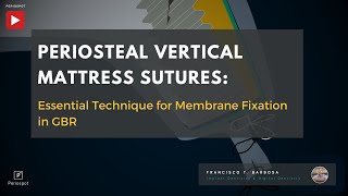 Periosteal Vertical Mattress Sutures Essential Technique for Membrane Fixation in GBR [upl. by Thia]