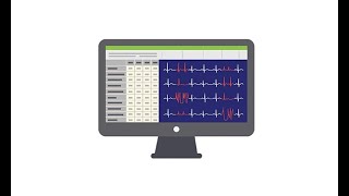 Reviewing the ECG of the Holter monitor [upl. by Samella]